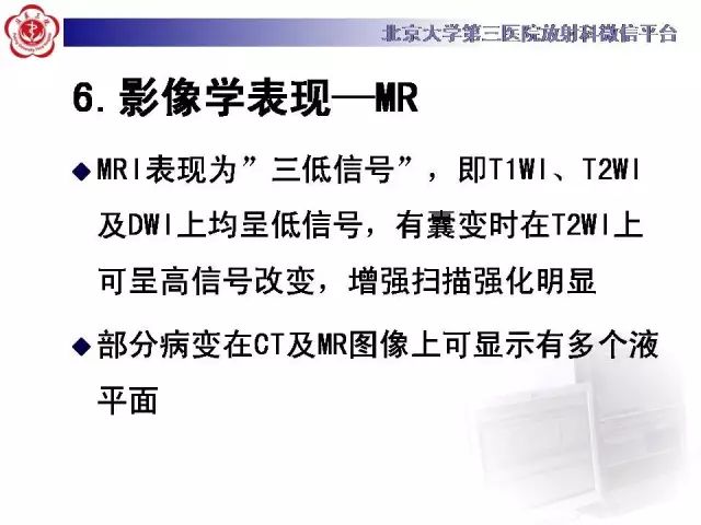 【病例】颅骨巨细胞修复性肉芽肿1例X线CT