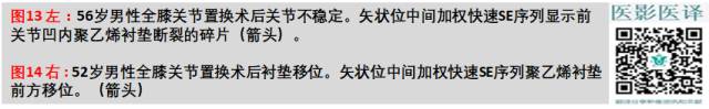 膝关节置换术后植入物的MR表现 膝关节置换术后植入物的MR表现