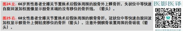 膝关节置换术后植入物的MR表现 膝关节置换术后植入物的MR表现
