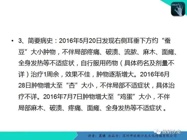【病例】腮腺淋巴管瘤1例MR