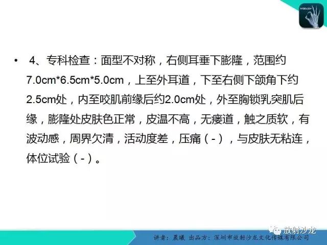 【病例】腮腺淋巴管瘤1例MR