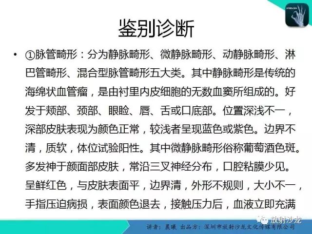 【病例】腮腺淋巴管瘤1例MR