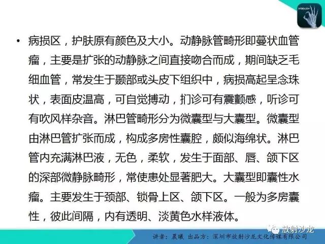 【病例】腮腺淋巴管瘤1例MR