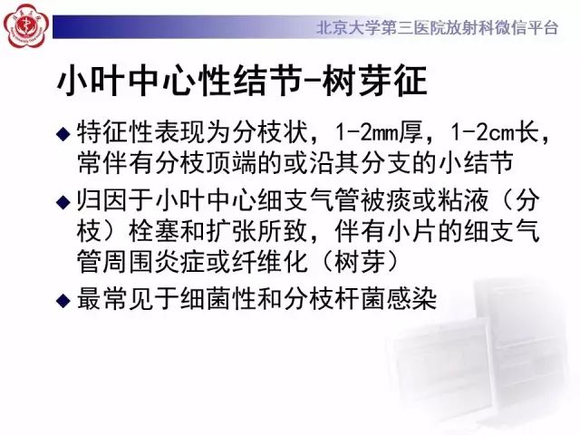 【PPT】(肺)结节(影像诊断)