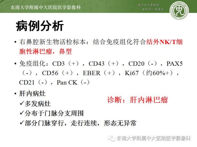 【病例】肝淋巴瘤1例CT影像表现 【病例】肝淋巴瘤1例CT影像表现