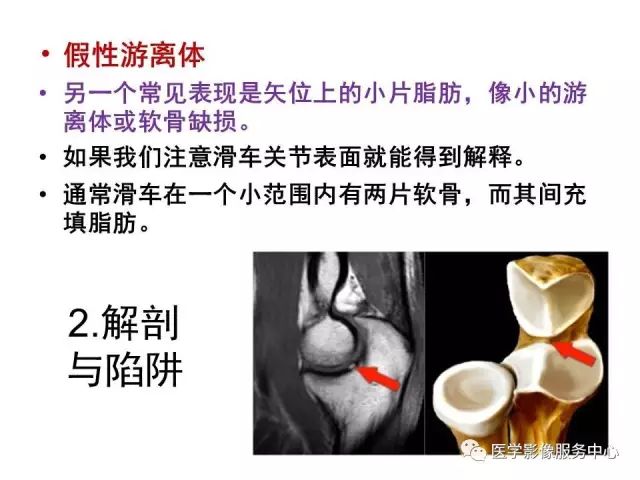 【PPT】肘关节MRI