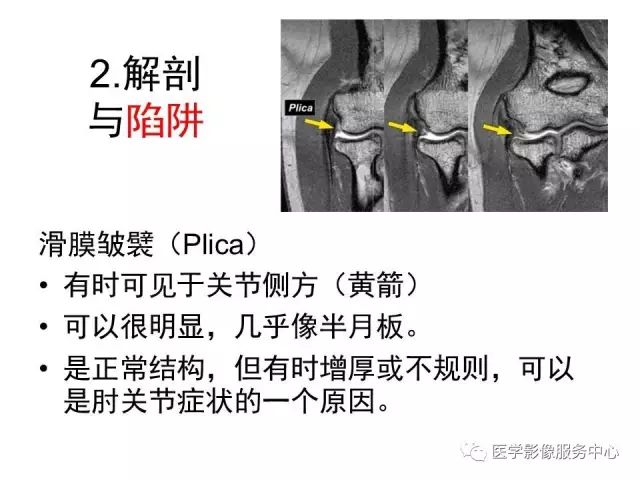【PPT】肘关节MRI
