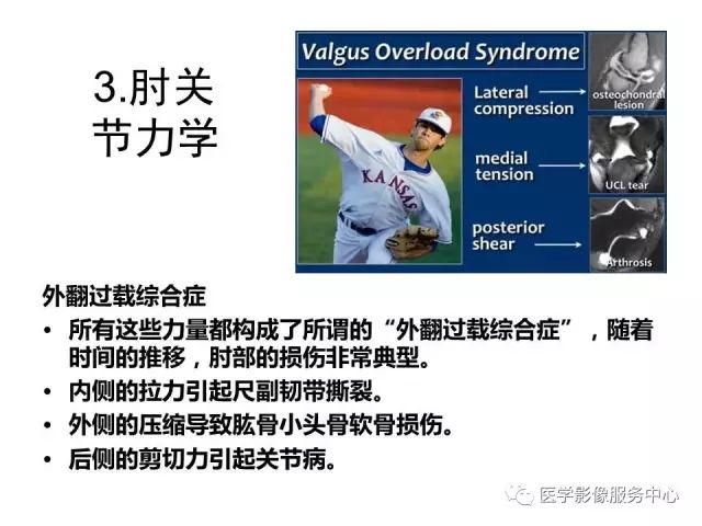 【PPT】肘关节MRI