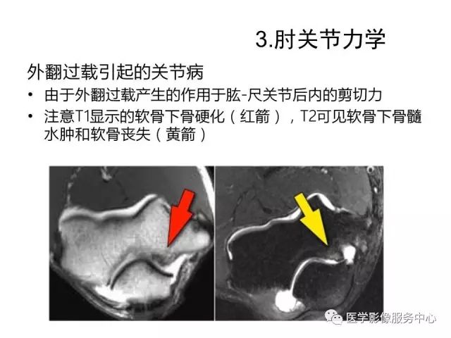 【PPT】肘关节MRI