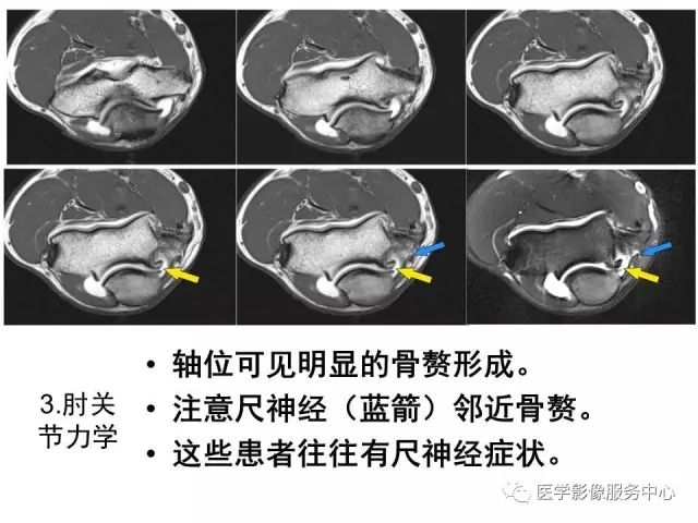 【PPT】肘关节MRI