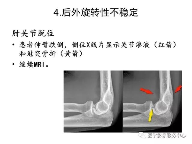 【PPT】肘关节MRI