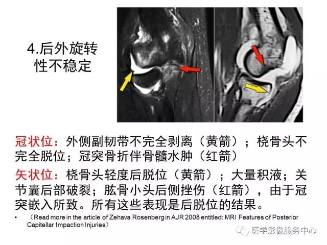 【PPT】肘关节MRI