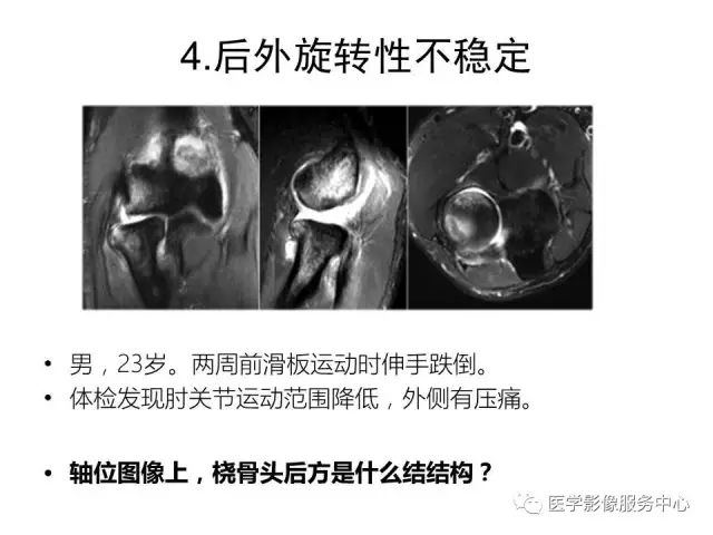 【PPT】肘关节MRI