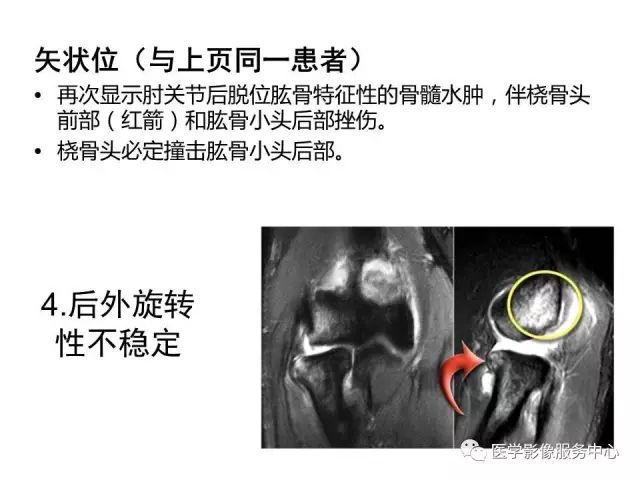 【PPT】肘关节MRI
