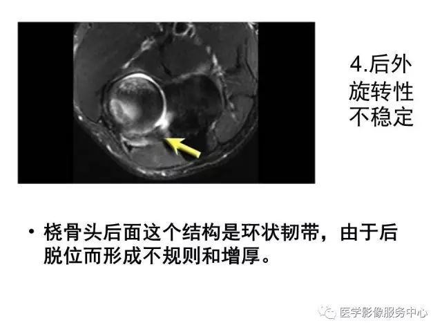 【PPT】肘关节MRI