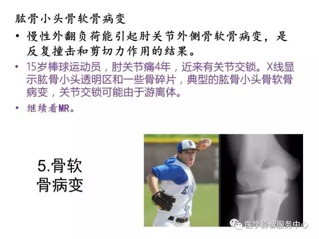 【PPT】肘关节MRI
