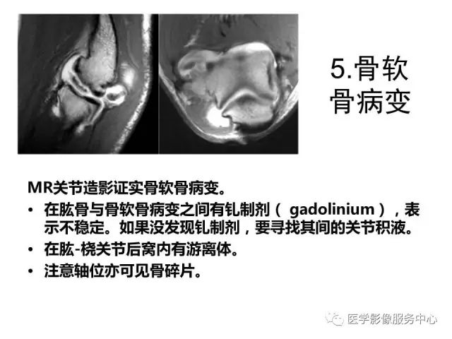 【PPT】肘关节MRI