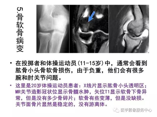 【PPT】肘关节MRI