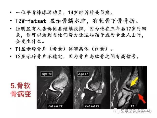 【PPT】肘关节MRI