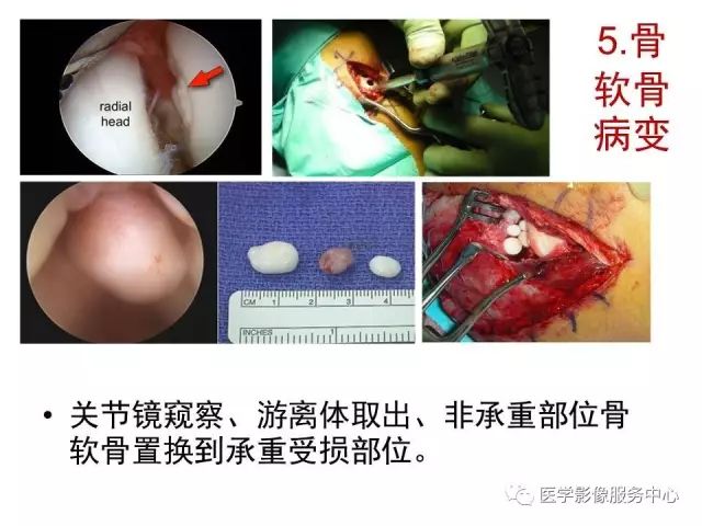 【PPT】肘关节MRI