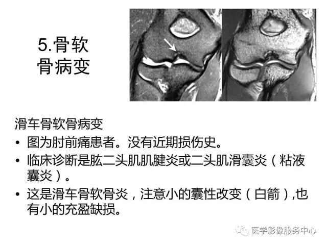 【PPT】肘关节MRI