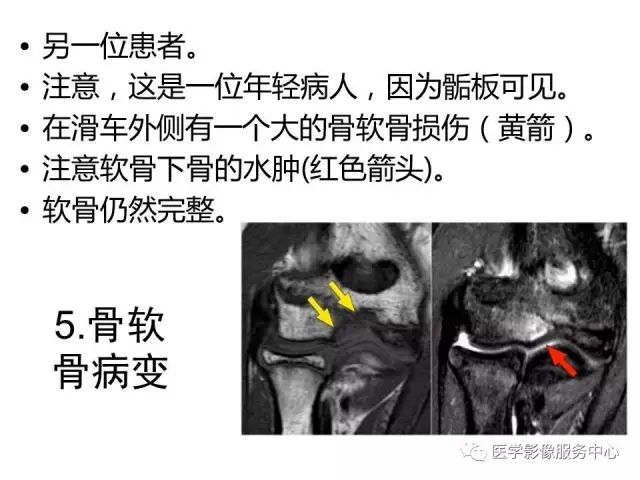 【PPT】肘关节MRI