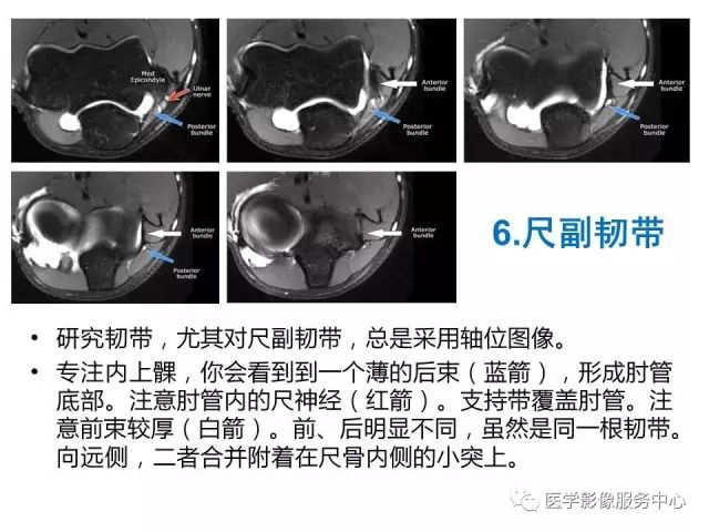 【PPT】肘关节MRI