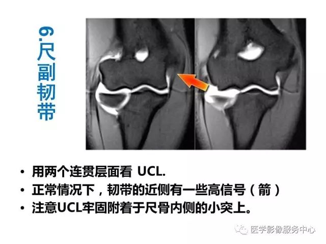 【PPT】肘关节MRI