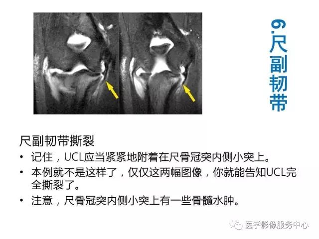 【PPT】肘关节MRI