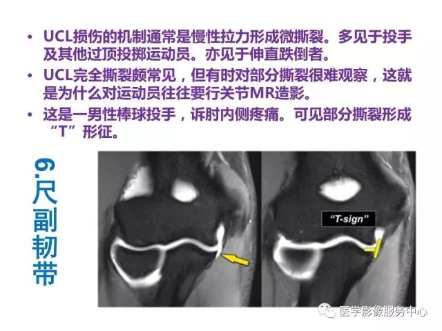 【PPT】肘关节MRI
