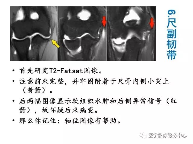 【PPT】肘关节MRI