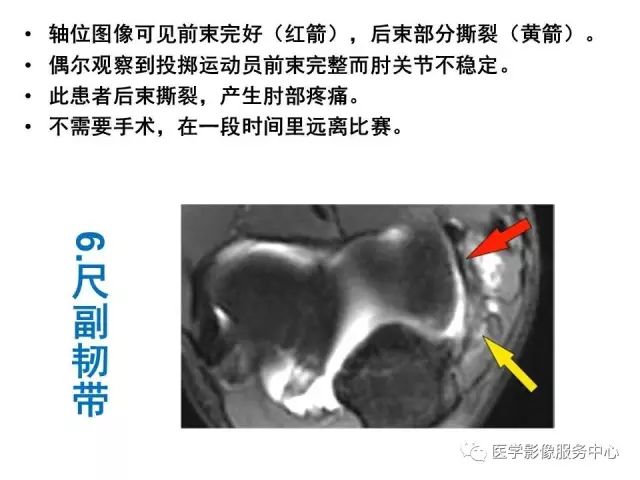 【PPT】肘关节MRI