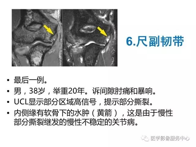 【PPT】肘关节MRI