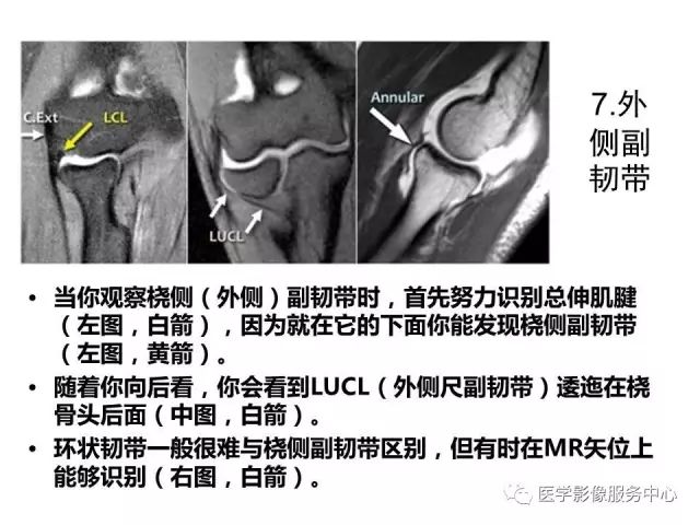 【PPT】肘关节MRI