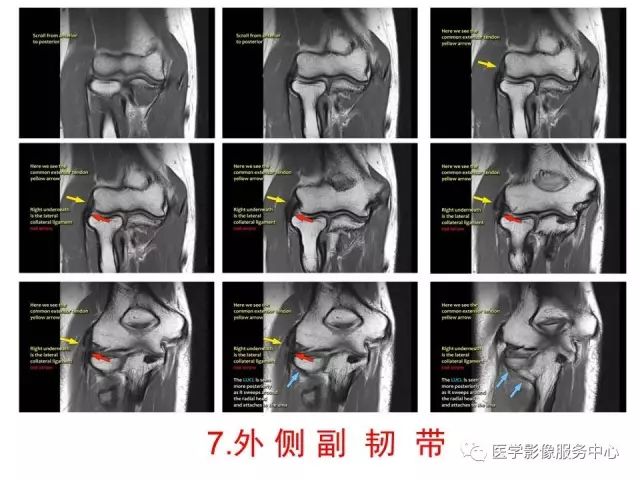 【PPT】肘关节MRI