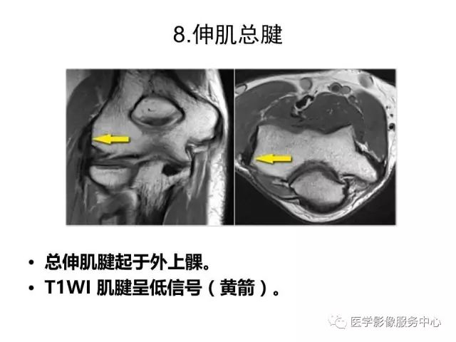 【PPT】肘关节MRI