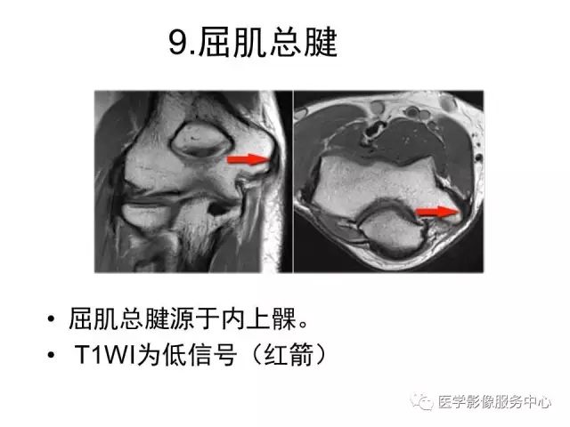 【PPT】肘关节MRI