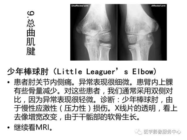 【PPT】肘关节MRI