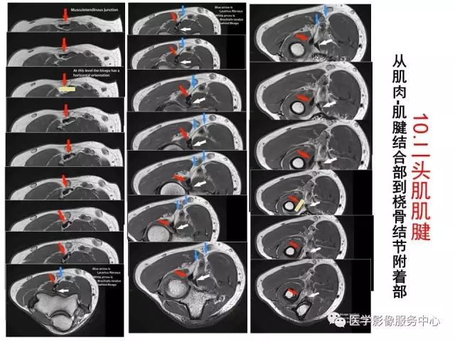 【PPT】肘关节MRI