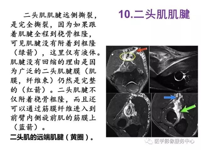 【PPT】肘关节MRI