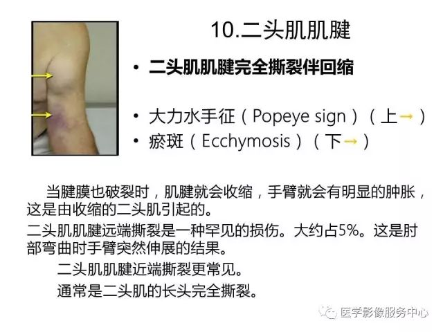 【PPT】肘关节MRI