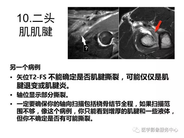 【PPT】肘关节MRI