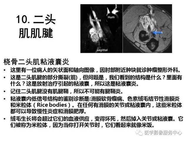 【PPT】肘关节MRI