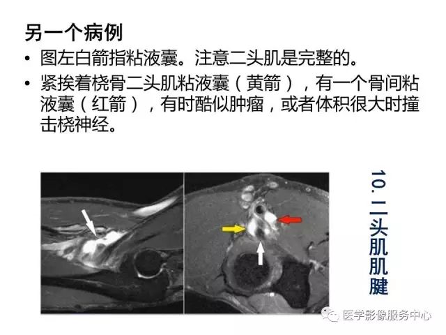 【PPT】肘关节MRI
