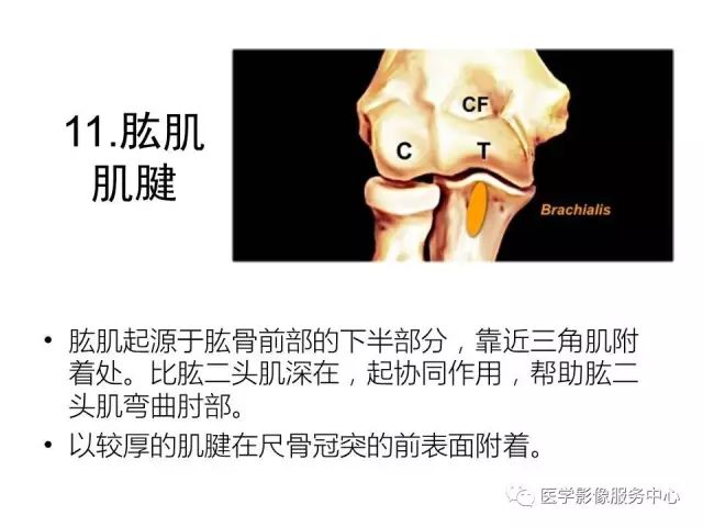 【PPT】肘关节MRI