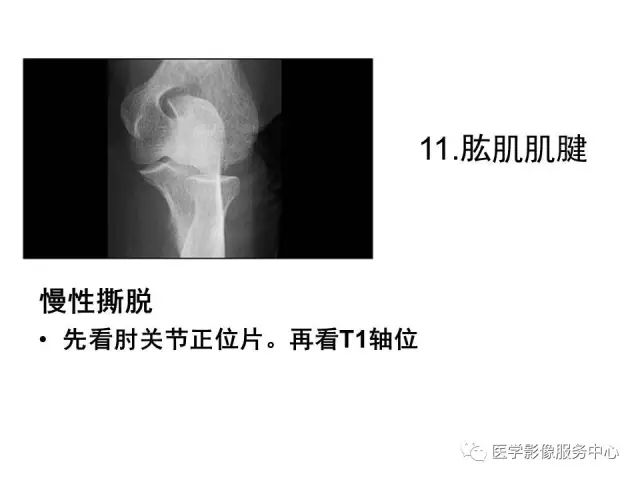 【PPT】肘关节MRI