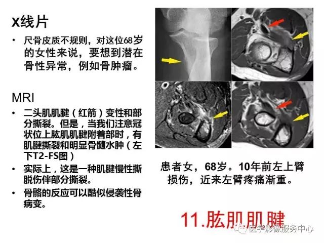 【PPT】肘关节MRI