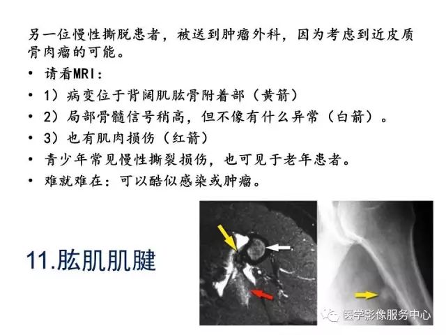 【PPT】肘关节MRI