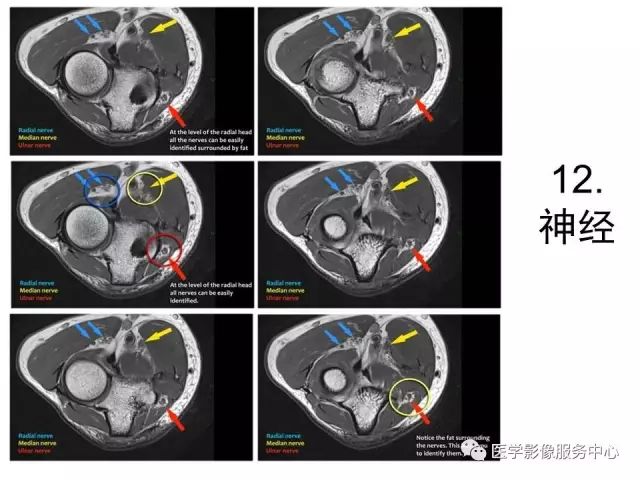 【PPT】肘关节MRI