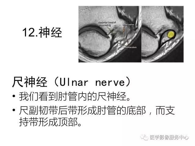 【PPT】肘关节MRI